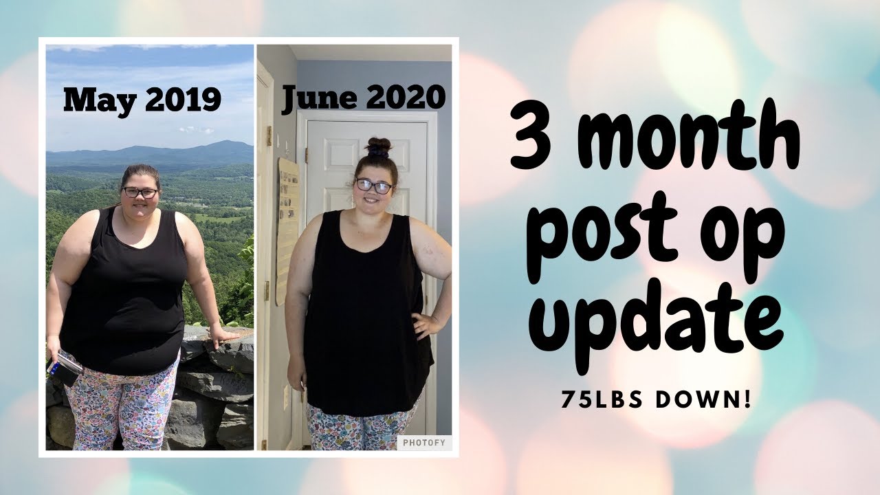 3 month postop UPDATE! 75lbs DOWN! gastric bypass YouTube