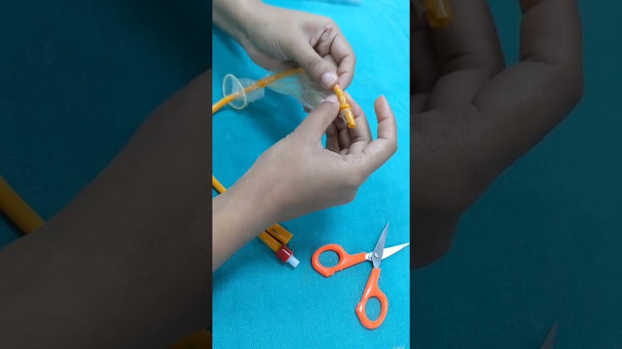 POST PARTUM HAEMORRHAGE-3/ ATONIC PPH/ MODIFIED CONDOM TAMPONADE CATHETER