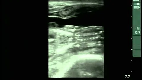 Cow #4539 Day 74 of Gestation