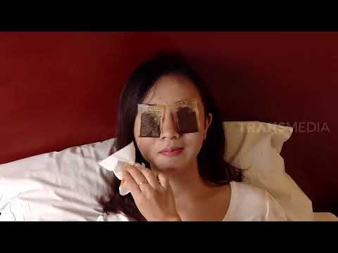 Apa Perbedaan Kantung Mata dan Mata Panda? | TAU GAK SIH (08/03/21)