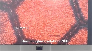 Vibration isolation of surgical microscopes