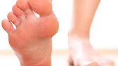 Desenex Athletes Foot Commercial 1994 - YouTube