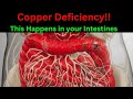 10 Signs You Have Copper Deficiency