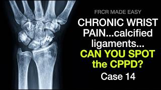 What is the Diagnosis? | MSK Radiology Case 14 screenshot 5