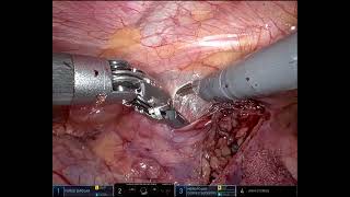 Welcome to Dr. Sandeep Dave's Surgery Channel