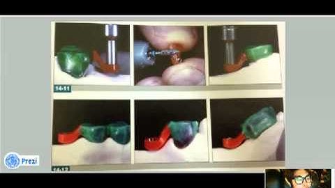 ceka attachment 동영상