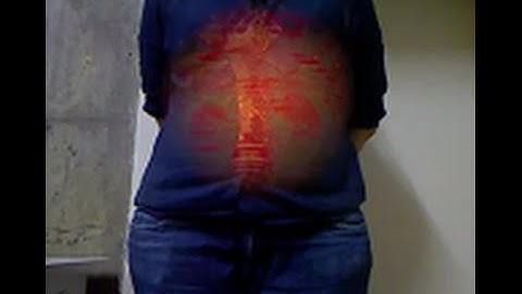 Focus+Context Visualization based on Volume Clipping for Markerless Medical Data Visualization