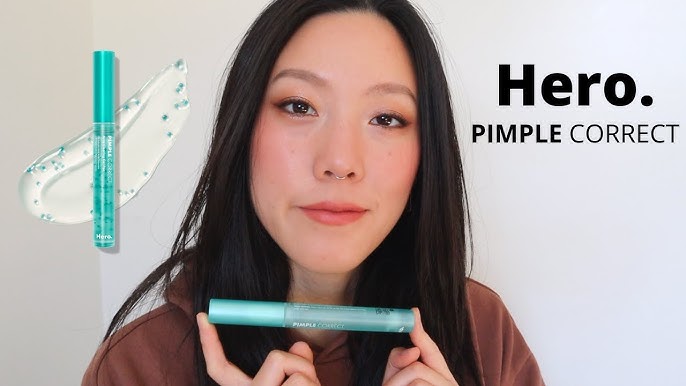 TESTING HERO MIGHTY PATCH & MICRO POINT ACNE PATCHES ON MY HORMONAL ACNE  FOR 1 WEEK 