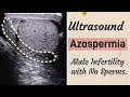 Scrotal Ultrasound - Azoospermia | Type,Causes -Male Infertility with No Sperms