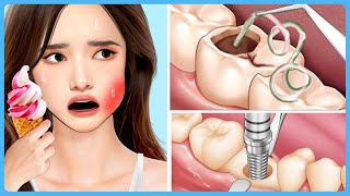 ASMR Wisdom Tooth & Cavity Treatment, Teeth Whitening | ASMR Animation