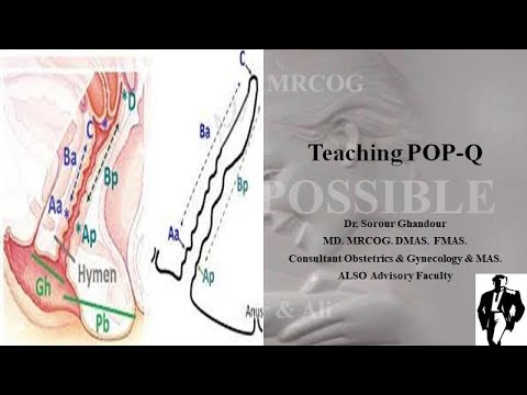 Pelvic Organ Prolapse Quantitifiaction System (POP - Q) MRCOG Part 2 & 3 Tasks