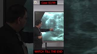 Case Studies | next part uploading soon #practicals #bilmed #medical #colordoppler #ultrasoundcourse