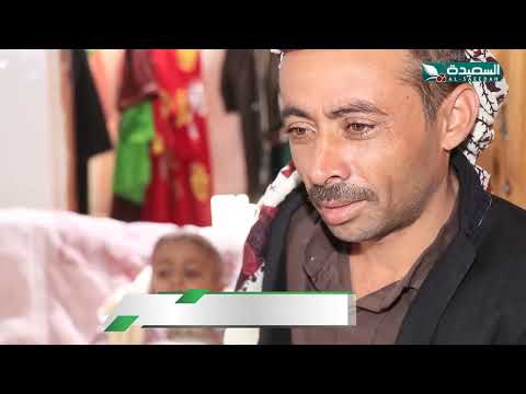 حالة إنسانية | الطفل عبدالله ومعاناته من ورم سرطاني في الدماغ | سنابل الخير