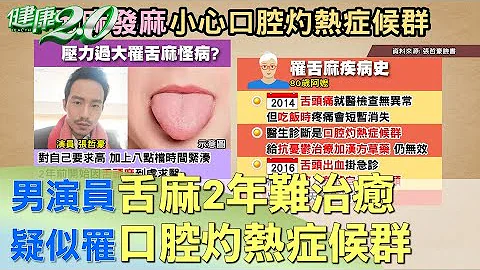 男演員舌麻2年難治癒 疑似罹口腔灼熱症候群 健康2.0 - 天天要聞