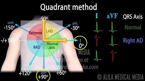 Cardiac Axis Interpretation  Animation