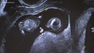 City votes to outlaw abortions and become sanctuary for the unborn
