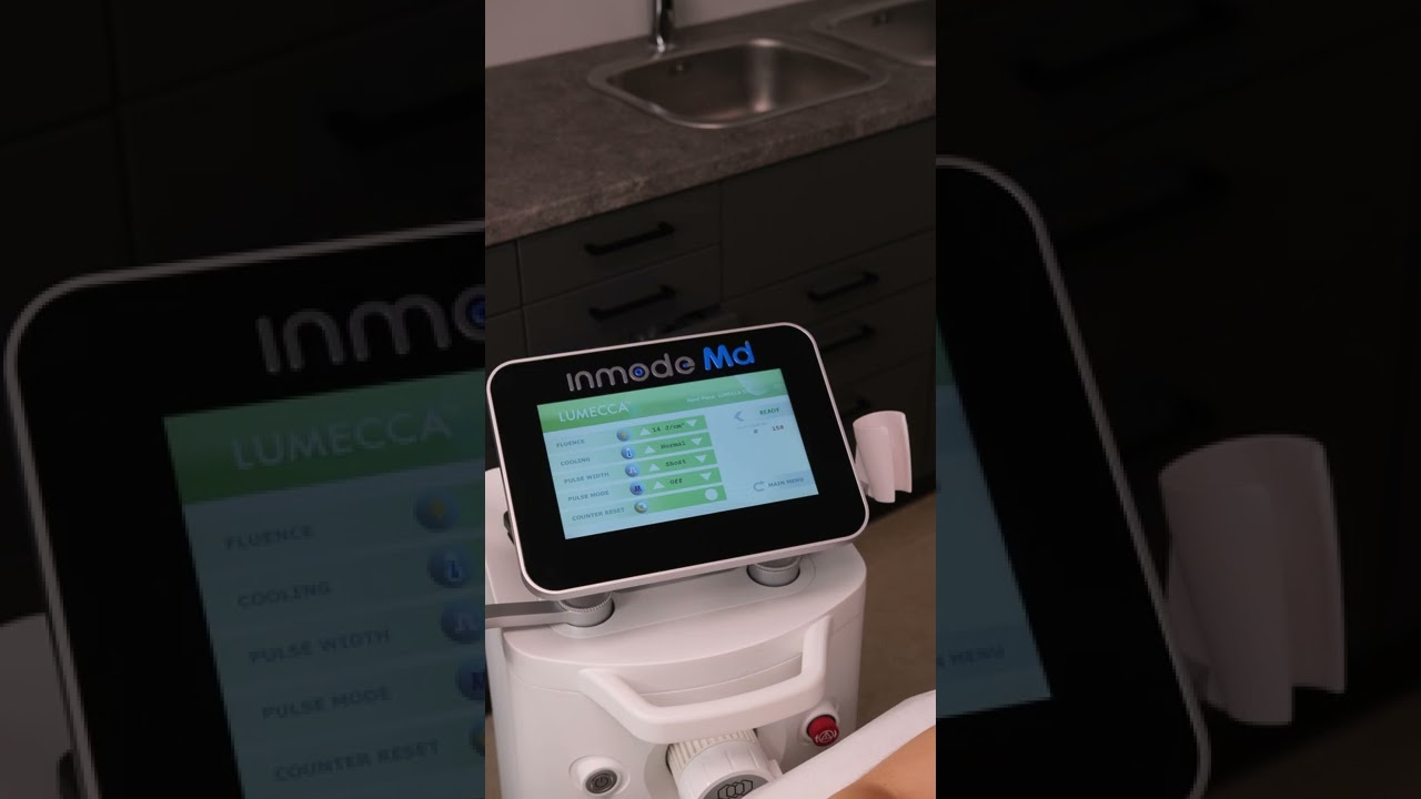 Процесс проведения процедуры IPL Lumecca