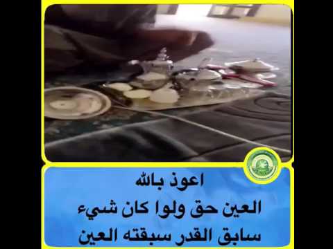 العين حق الله يكفينا ويكفي المشاهدبن شرها