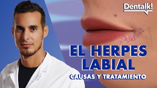 Do you have a cold sore? These are the causes and treatment of fever blisters on the lip | Dental...