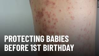 Doctors urge earlier MMR vaccine amid measles outbreak