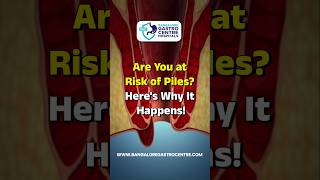 What Causes Piles? Know the Real Reasons Behind Hemorrhoids