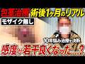 【モザイクなし】根部切開で感度はどうなる?術後1ヶ月の患者密着