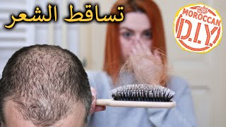 (By Moroccan-DIY) جميع وصفات علاج تساقط الشعر و تقويته في المنزل