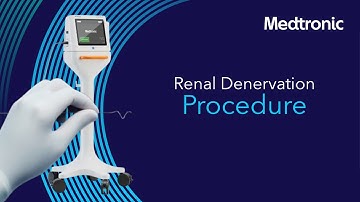 Radiofrequency Renal Denervation Procedure