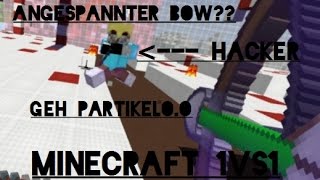Hacker Report [Name: GKR]   Minecraft [Timolia] 1vs1