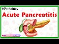 Acute Pancreatitis: Etiology , signs and Symptoms, pathophysiology , Diagnosis, Treatment