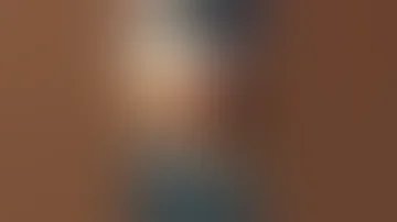شاهد الفتق الاربي اثناء العملية الدكتور حمزة الحلواني 