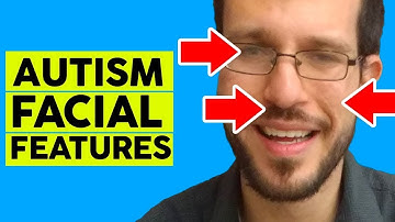 Autism Facial Feature - Aspergers Facial Characteristics