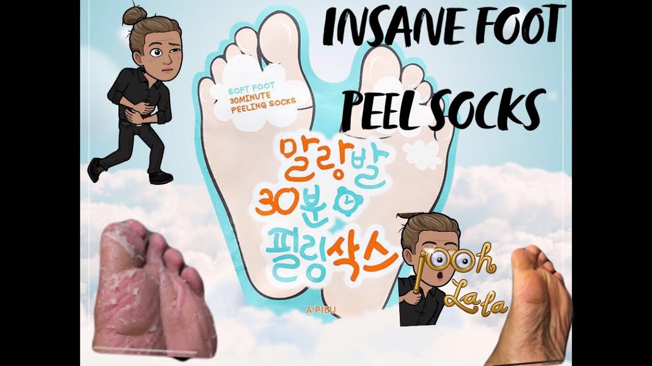 INSANE KOREAN FOOT PEEL SOCK!