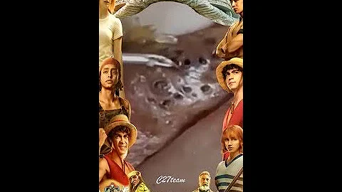 Blackheads Removal | Acne Treatment and Very Satisfying Satisfying Pimple pop #blackheads