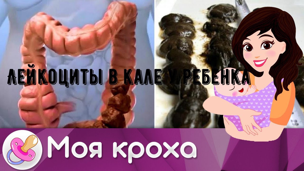 Лейкоциты в кале у ребенка