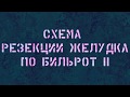 Схема резекции желудка по Бильрот II