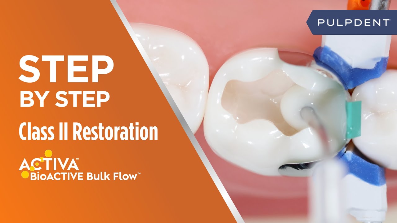 Step by Step Class II Restoration with Activa BioACTIVE Bulk Flow - YouTube