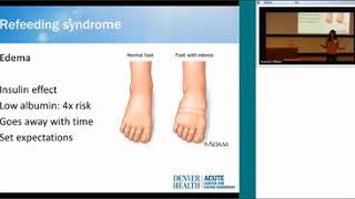 Medical Complications Of Eating Disorders   Silber Lecture Gaudiani 4 27 16 1
