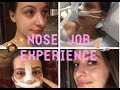 NOSE JOB RECOVERY VLOG | FROM SURGERY TO CAST OFF