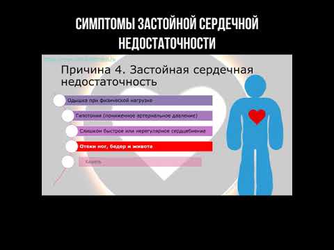 Симптомы застойной сердечной недостаточности