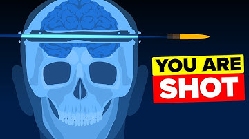 What Does it Actually Feel Like to be Shot in the Head