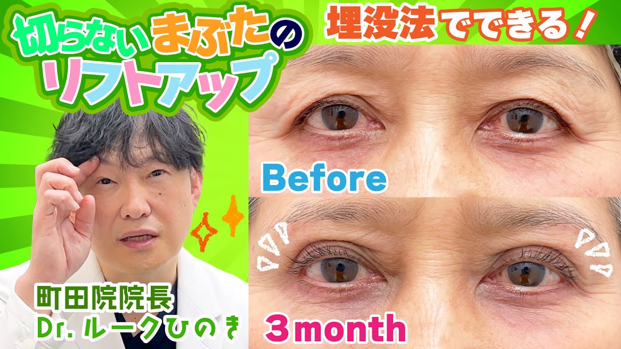 New Procedure] Must-Watch for Ages 40+: 