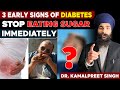 3 warning signs of diabetes  stop eating sugar immediately if you have these  dr kamalpreet singh
