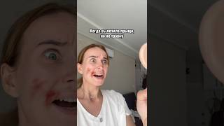 Что помогло вылечить прыщи: Артикулы wb Сыворотка 355684966 Энзимная пудра 436482206 Маска 390076214