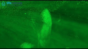 Endogenous Thy1-driven YFP expression visualized throughout an entire adult mouse brain