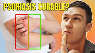 Can Psoriasis be Cured? | Understanding Inflammation & Psoriasis | Anti-inflammatory Medications