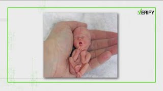 Is a picture of a 12-week-old fetus outside the womb real? | VERIFY