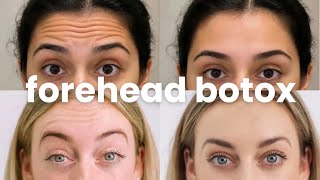 need that $667.99 forehead botox? here, it's free! [subliminal] screenshot 5