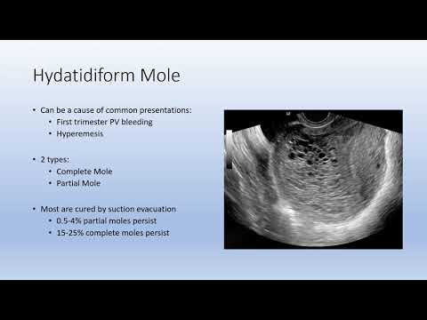 गर्भकालीन ट्रोफोब्लास्टिक रोग (जीटीडी)