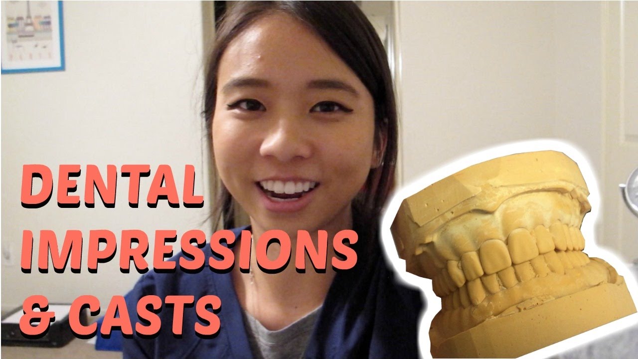 First Alginate Impressions and Stone Casts Brittany Goes to Dental